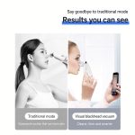 Visual Blackhead Vacuum with Camera – 20X Magnification & 6 Suction Levels - Image 3