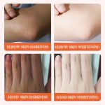 Dark Spot Brightening Body Serum – Niacinamide & Vitamin C, 50ml - Image 4