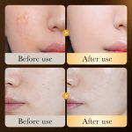 24K Gold Hyaluronic Acid Skincare Series - Image 3